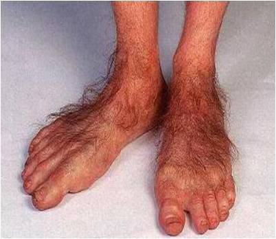 hobbit-feet1